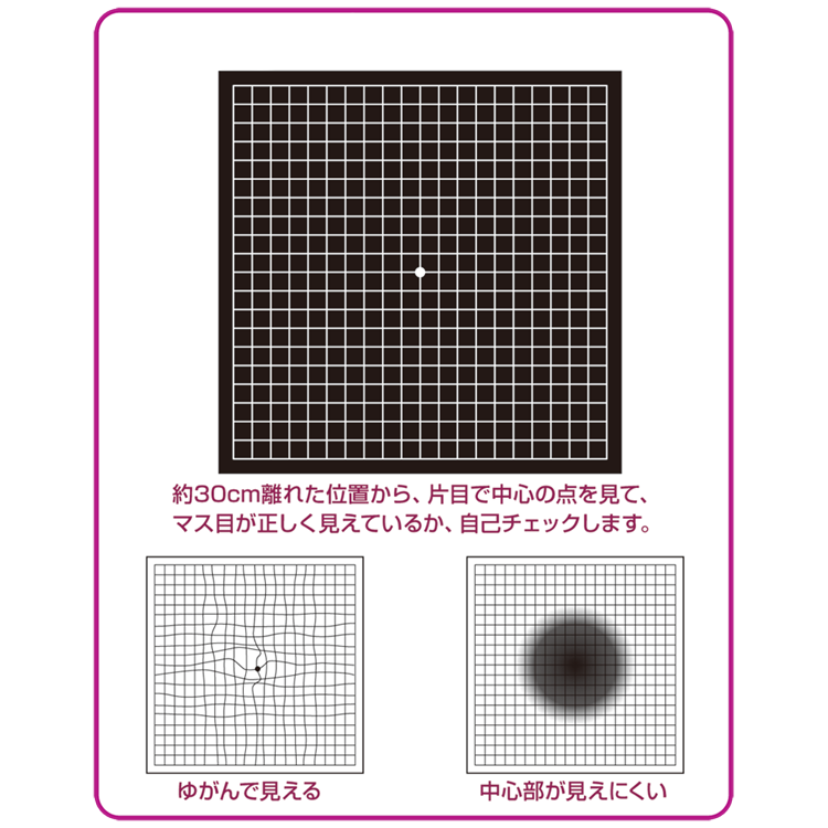 視界 の 一 部 が ゆがむ